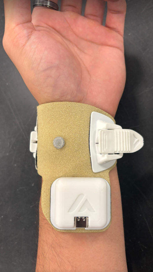 Wrist form factor, palm-side view